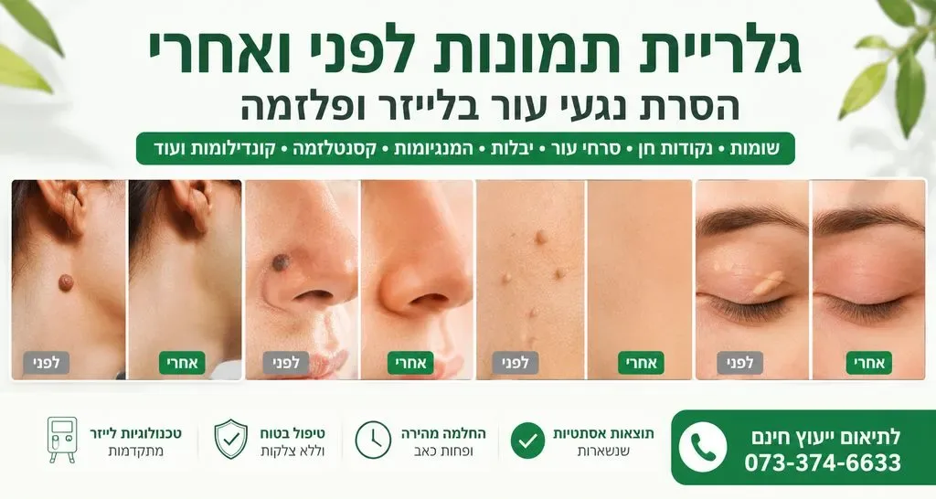 גלריית תמונות לפני ואחרי