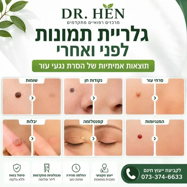 גלריית תמונות לפני ואחרי -מעודכן תאריך: 19/07/2026