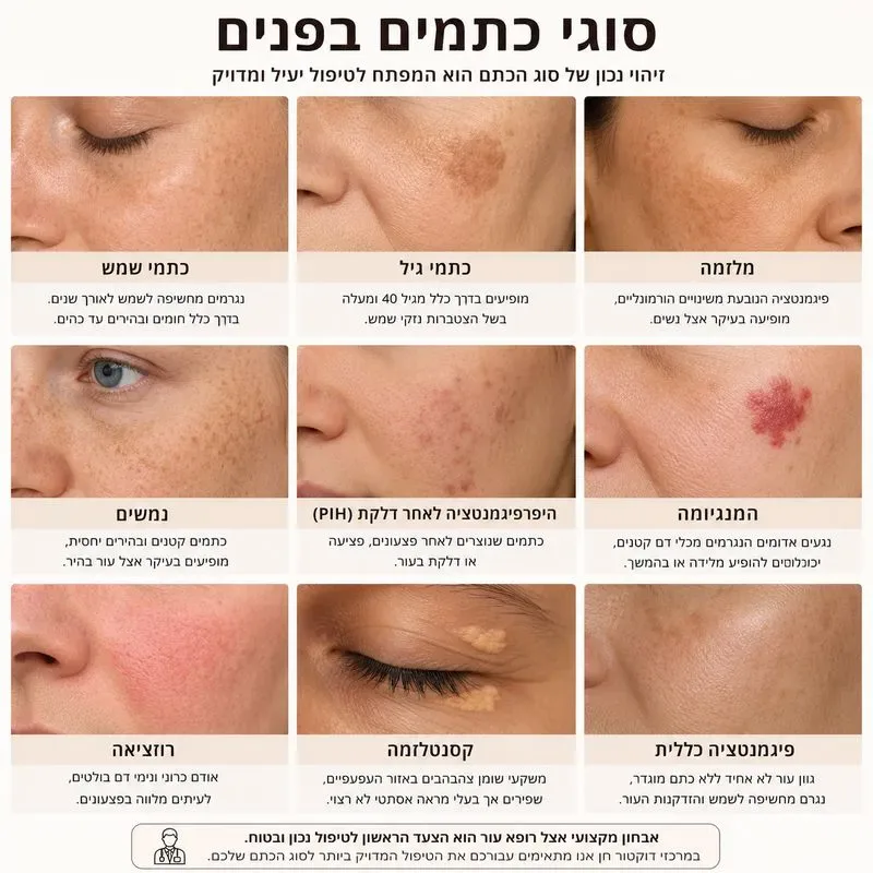 סוגי כתמים בפנים - תמונות לפי סוג הכתם והסברים