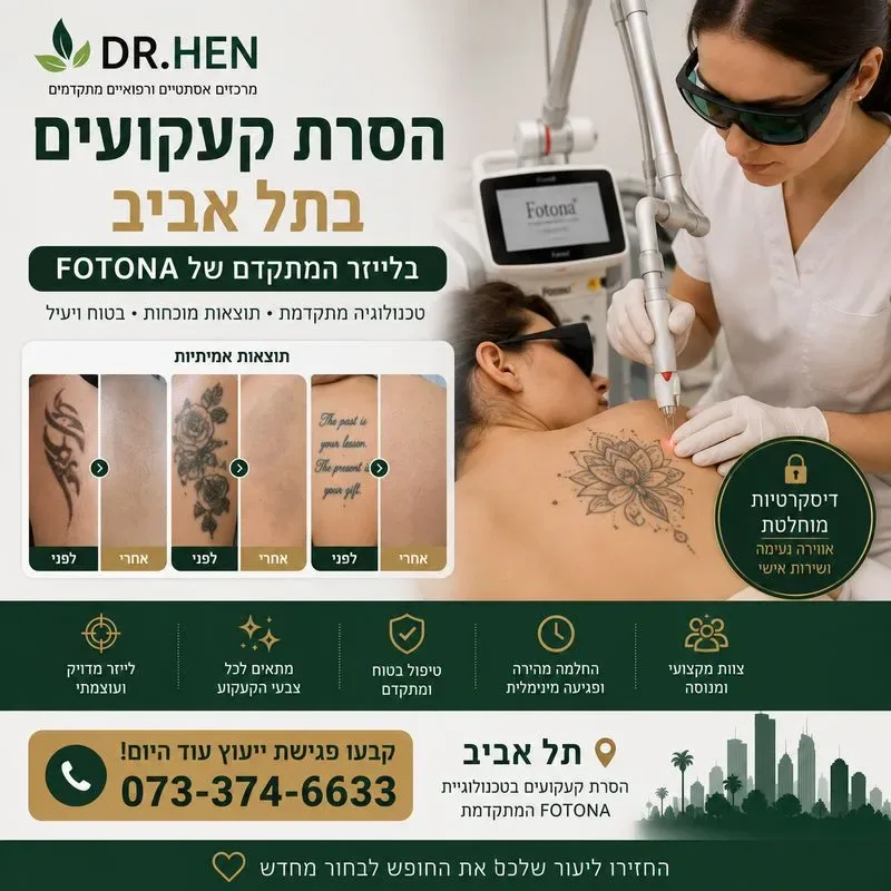 הסרת קעקועים בלייזר בתל אביב