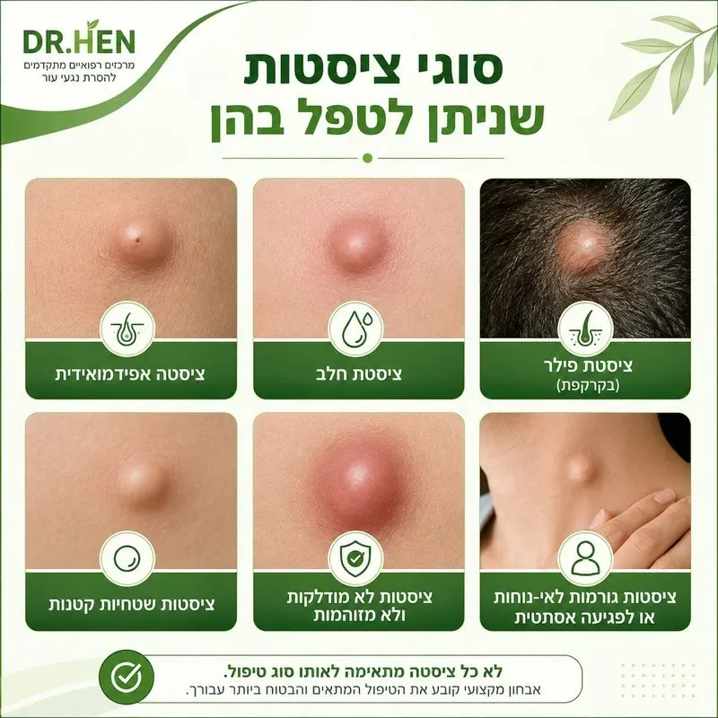 סוגי ציסטות שניתן לטפל