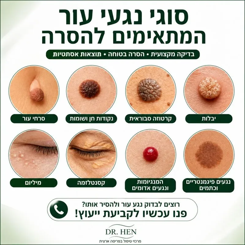 סוגי נגעי עור המתאימים להסרה