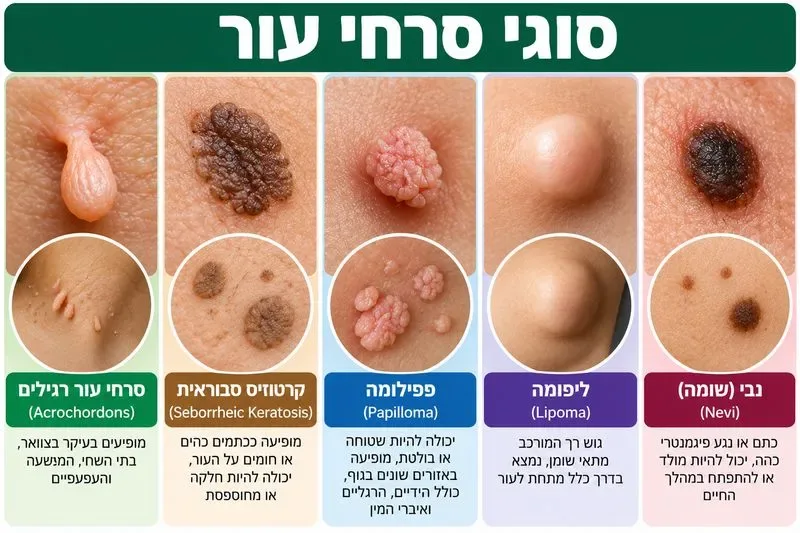 סוגי סרחי עור