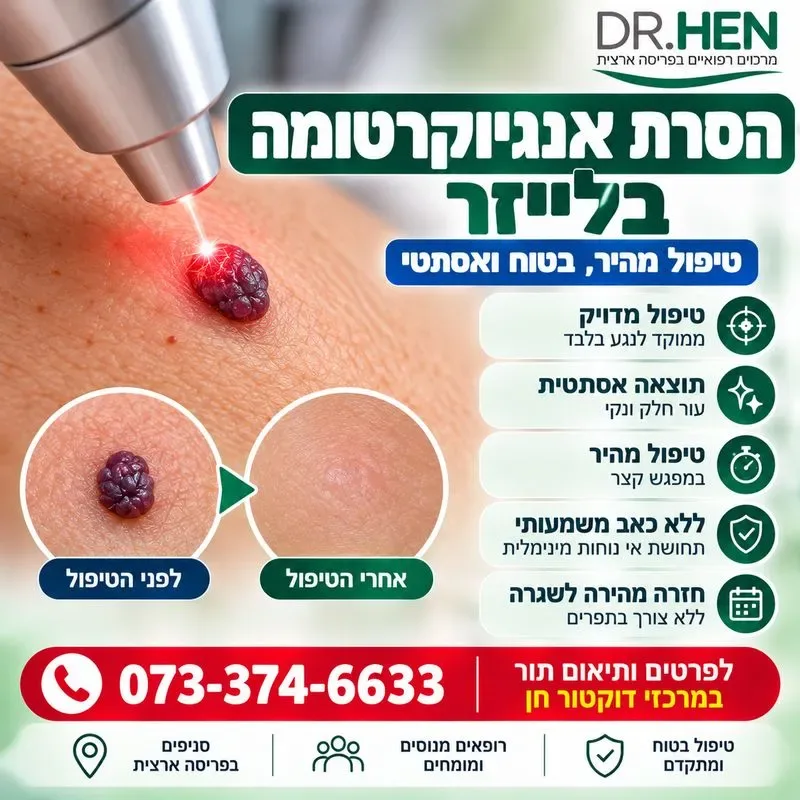הסרת אנגיוקטומה בלייזר יתרונות