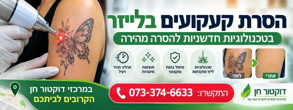 הסרת קעקועים בלייזר