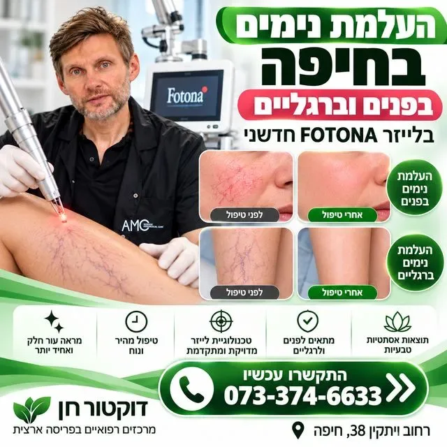 העלמת נימים בלייזר בחיפה | העלמת נימים ברגליים בחיפה | העלמת נימים בפנים בחיפה