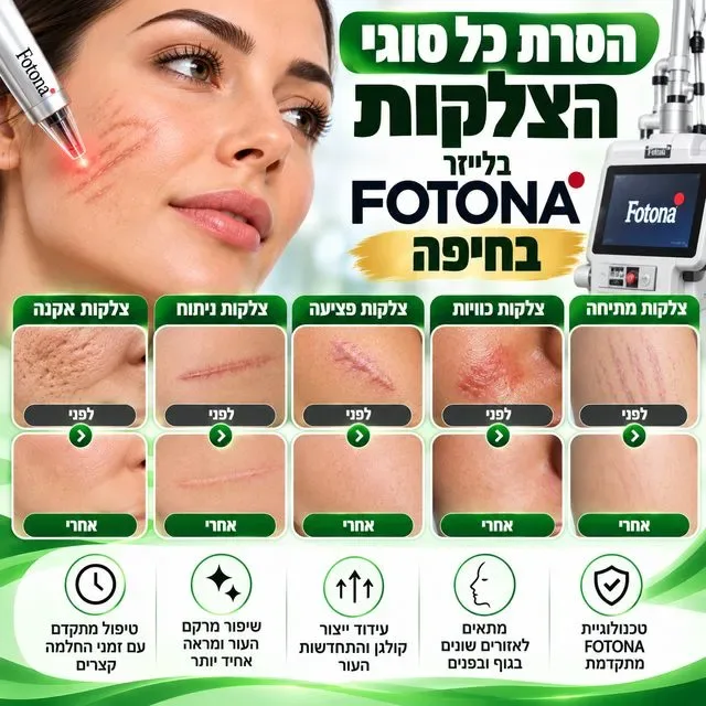 הסרת צלקות בחיפה