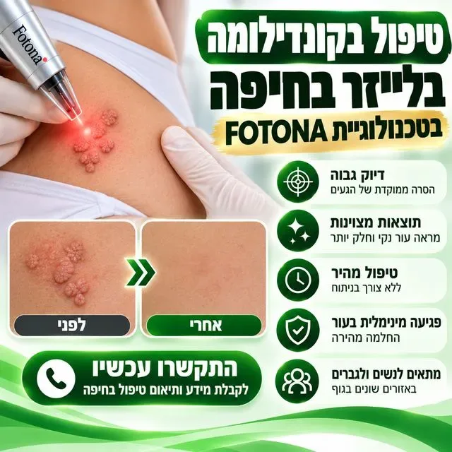 טיפול בקונדילומה בלייזר בחיפה