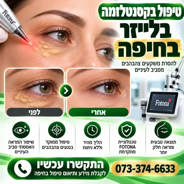 טיפול בקסנטלזמה בחיפה