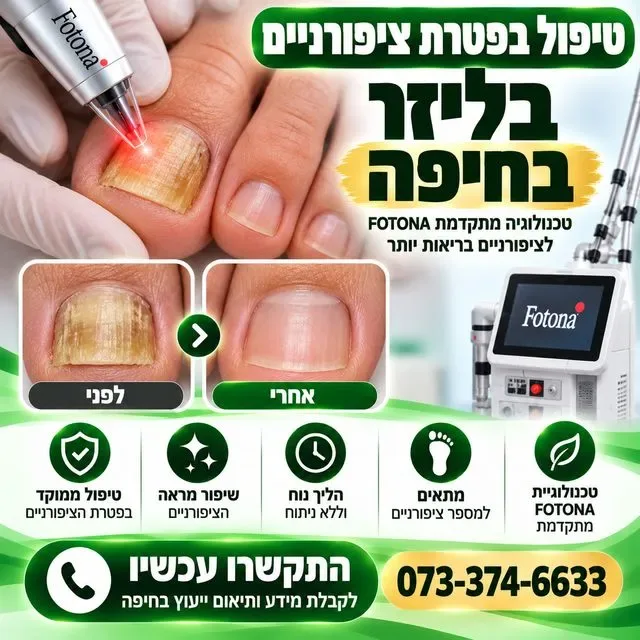 טיפול בפטרת ציפורניים בלייזר בחיפה