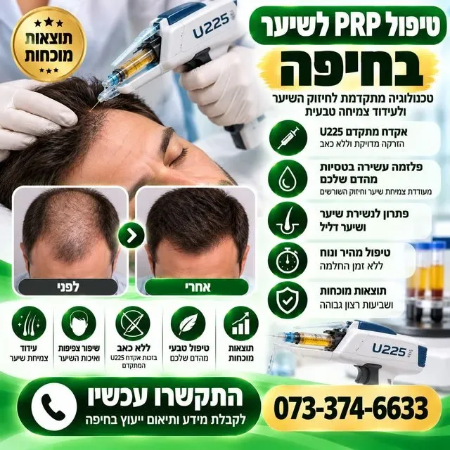 טיפול PRP לשיער בחיפה
